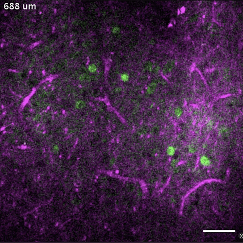 Photo graph of mouse brain at microscopic leel