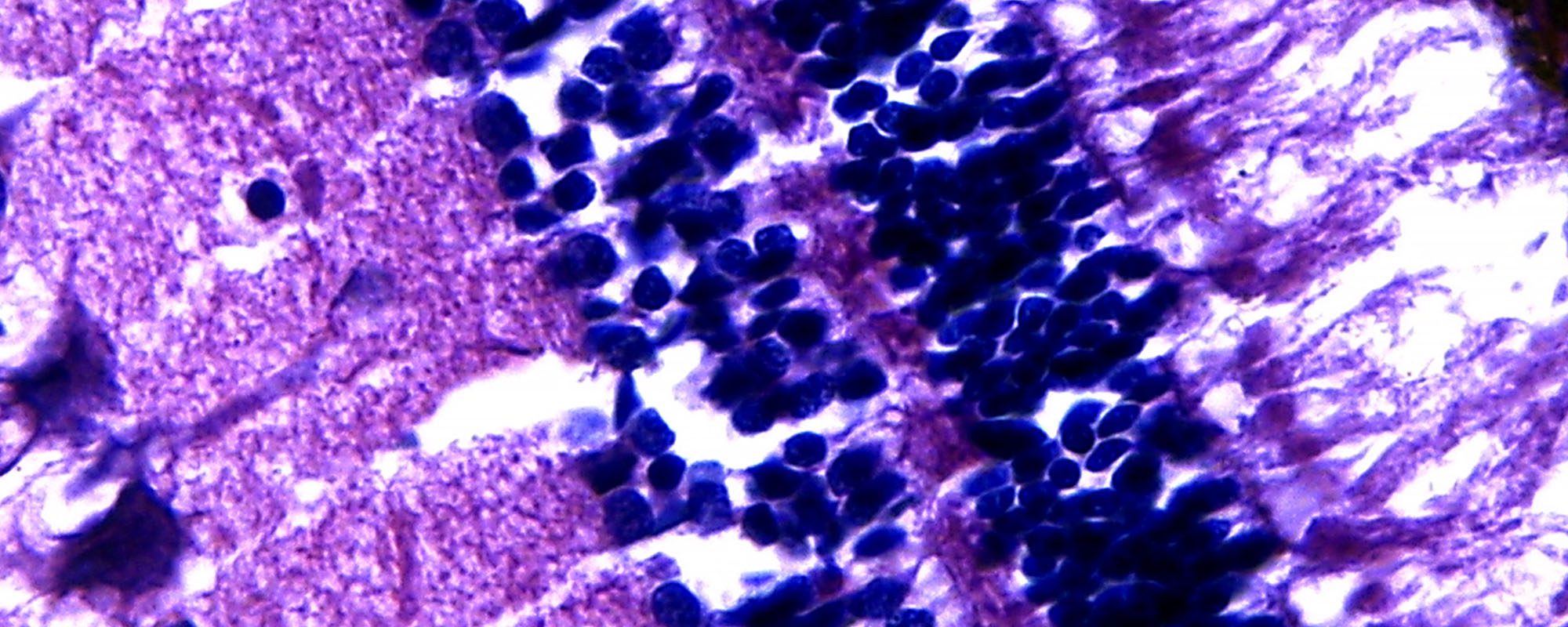close up of animal cells seen under microscope and dyed purple