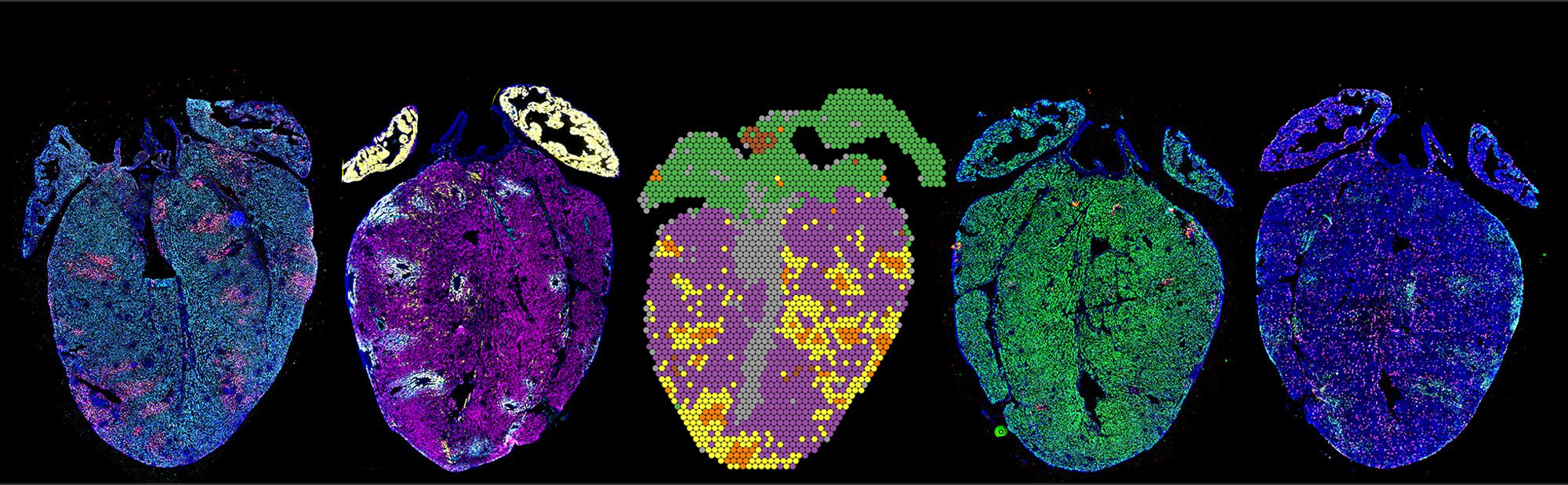 Systems and Synthetic Biology imaging of human heart De Vlaminck Lab