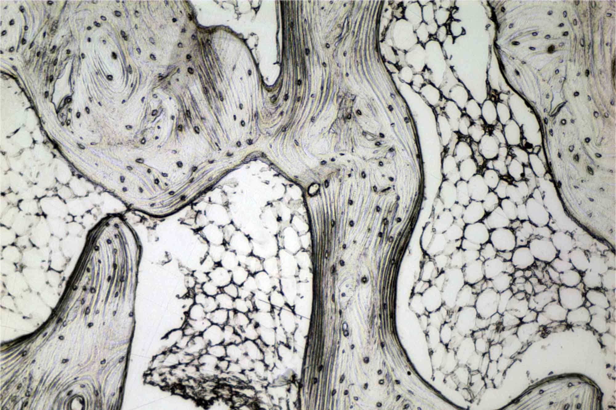 Bonassar lab micrograph bone and orthopaedics research image.