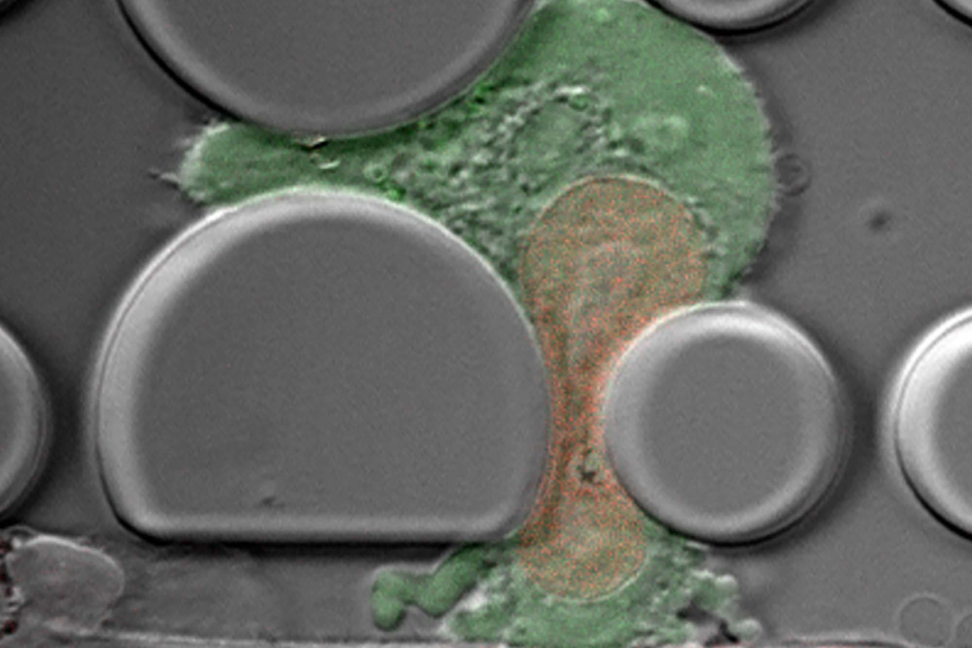 A cancer cell gets squished by nanostructures Lammerding lab research