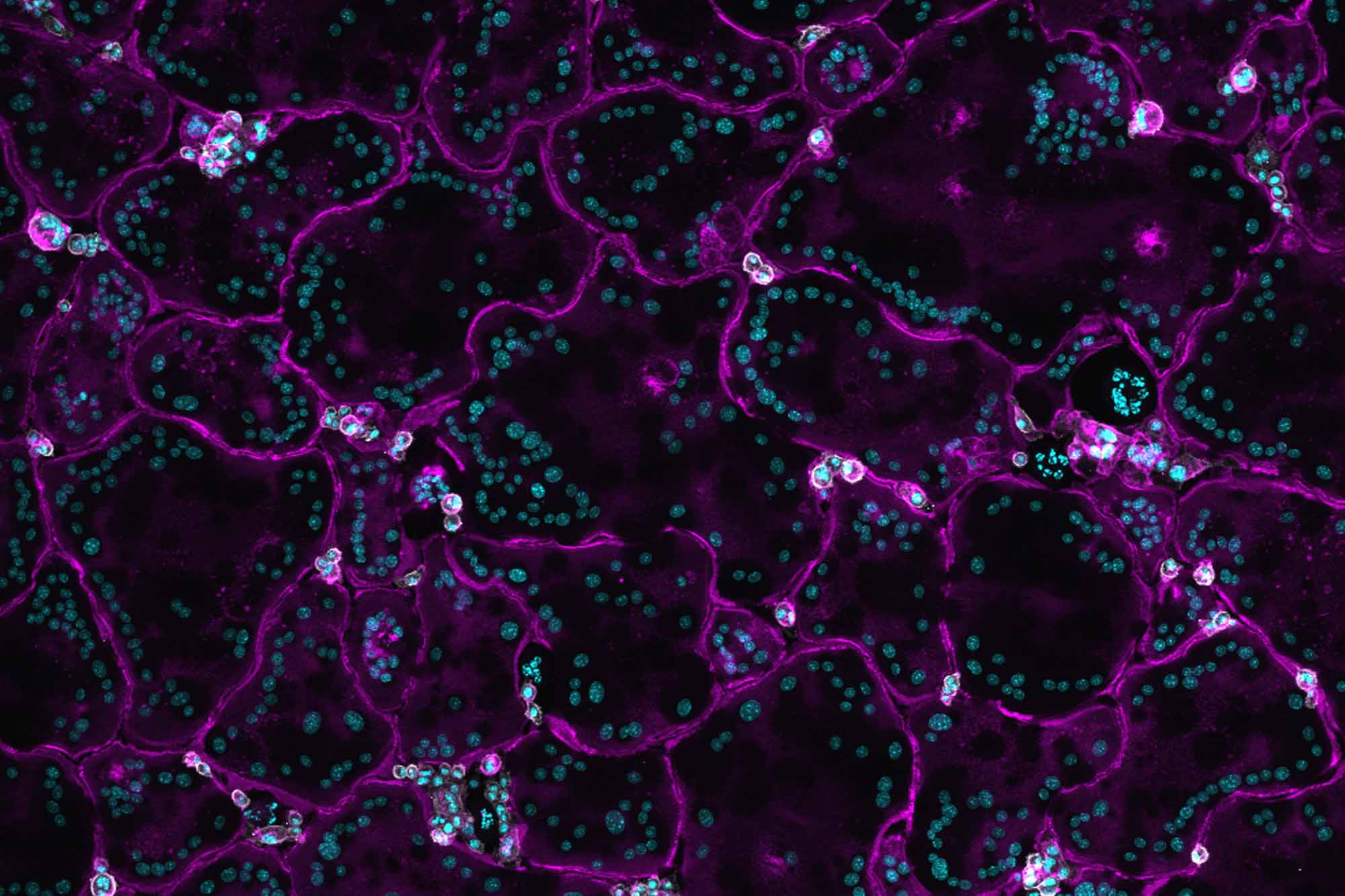 Fischbach-primary osteoclasts on glass