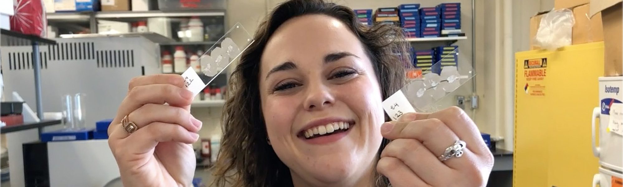 Undergraduate student in lab holding up microscope slides.