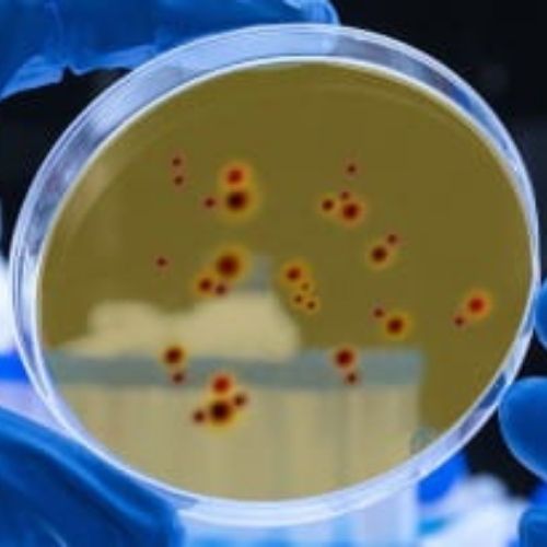 Mesenchymal Stromal Cells in a petri dish in the Van Vliet lab