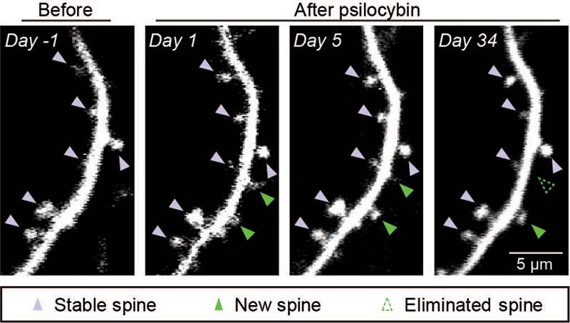 In a recent study, Kwan and colleagues showed that a single dose of psilocybin causes long-lasting changes in neuronal connectivity in the mouse brain (Shao et al., Neuron, 2021).