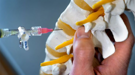 hand holding model spine with needle