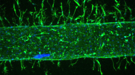lymphatic sprouting from the 3D lymphatic vessel on-a-chip in vitro