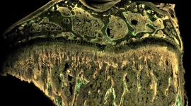 bone cross-section is labeled with fluorescent dyes to measure the dynamics of bone formation.