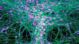 Serotonin neurons as seen from under a confocal laser scanning microscope