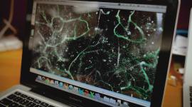 brain imaging on laptop screen