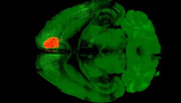 medical scan of a brain